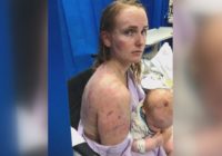Mom recovering after shielding baby during hailstorm
