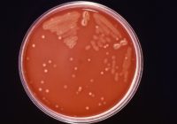 Florida seeing 'abnormal' increase in flesh-eating bacteria cases due to Hurricane Ian